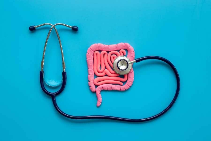 cáncer de colon en jóvenes