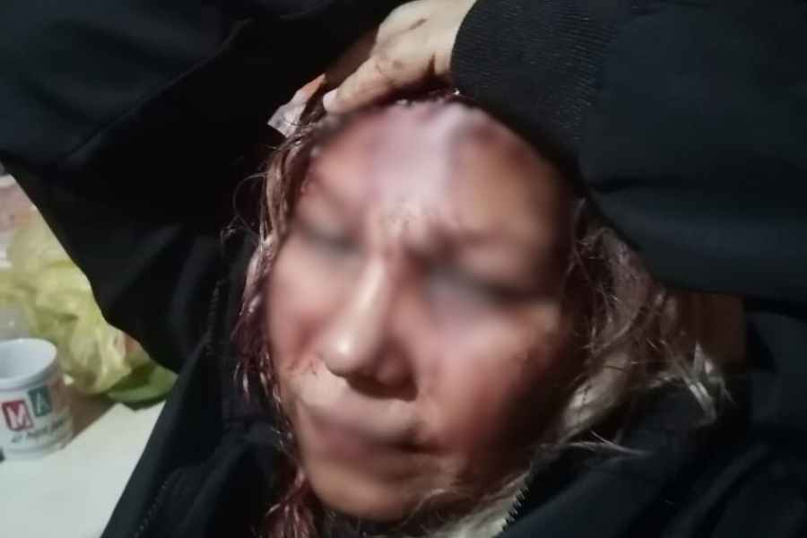 Hombre agrede a su hermana con una vaporera y pide ayuda antes de huir en Matamoros