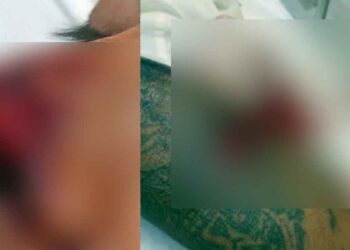 Hombre víctima de ataque de pitbull pide justicia por agresión en San Nicolás, NL