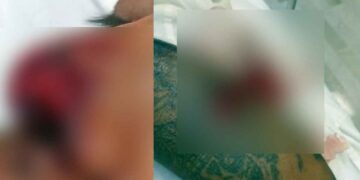 Hombre víctima de ataque de pitbull pide justicia por agresión en San Nicolás, NL