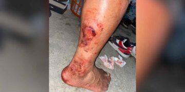 Peatón sufre ataque de perro en avenida Marte R. Gómez en Matamoros