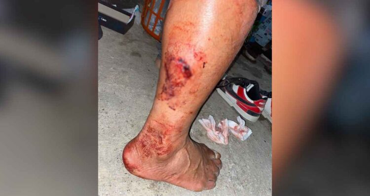 Peatón sufre ataque de perro en avenida Marte R. Gómez en Matamoros