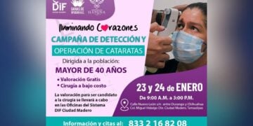 operación de cataratas gratis en Madero