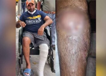 Familia de Juan Luis pide ayuda urgente tras accidente en motocicleta en Ciudad Victoria
