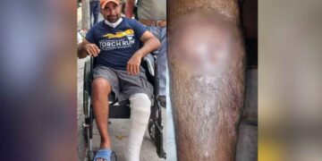 Familia de Juan Luis pide ayuda urgente tras accidente en motocicleta en Ciudad Victoria