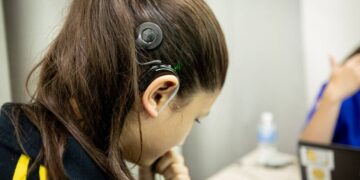 DIF Tamaulipas calibra implantes cocleares para pacientes de Cd. Victoria y Nuevo Laredo