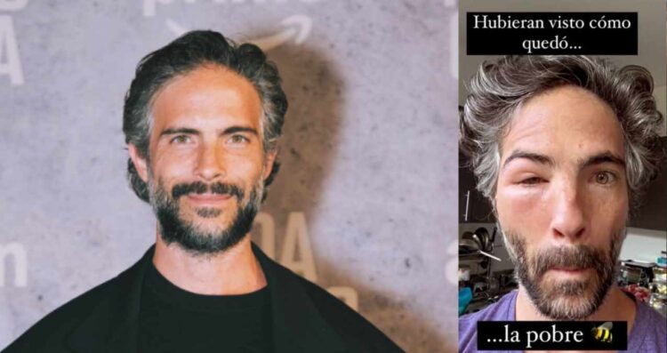 ¿Qué le pasó en el rostro al guapísimo actor Osvaldo Benavides