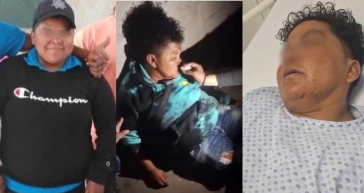 Activista en coma tras brutal ataque de ex militar en Izúcar de Matamoros, Puebla VIDEO
