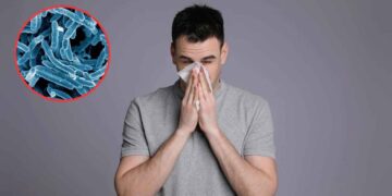 Alerta por repunte de casos de tuberculosis en México ¿Cuáles son los síntomas