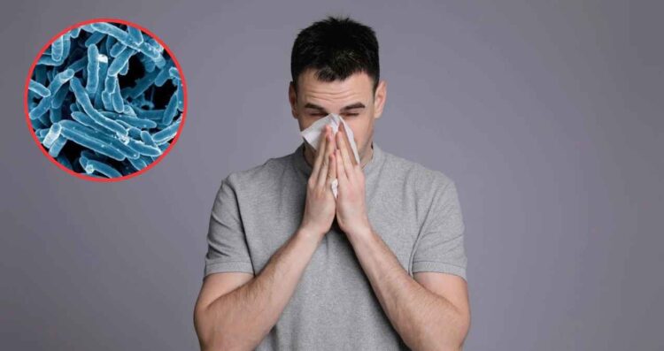 Alerta por repunte de casos de tuberculosis en México ¿Cuáles son los síntomas