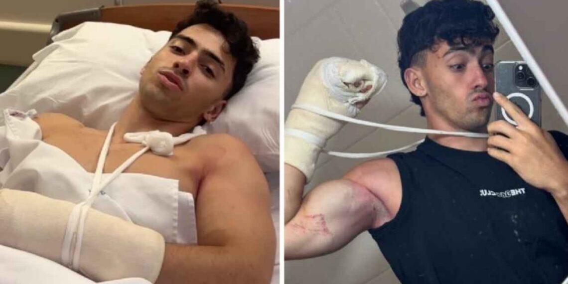 Influencer argentino sufre accidente en un cerro y pierde parte de los dedos