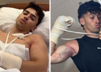 Influencer argentino sufre accidente en un cerro y pierde parte de los dedos