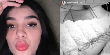 Karely Ruiz preocupa a sus seguidores tras revelar problemas de salud