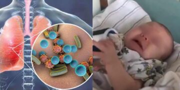 Tosferina causa muere de bebé en Nuevo León