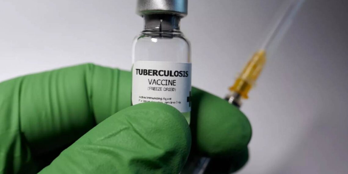 casos de tos ferina en Tamaulipas