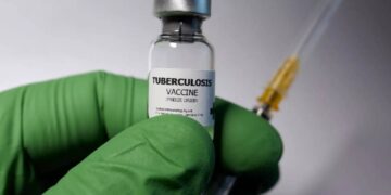 casos de tos ferina en Tamaulipas