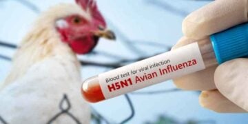 Fallece niña de 3 años que recibía atención médica tras contagiarse de influenza aviar H5N1 en Torreón