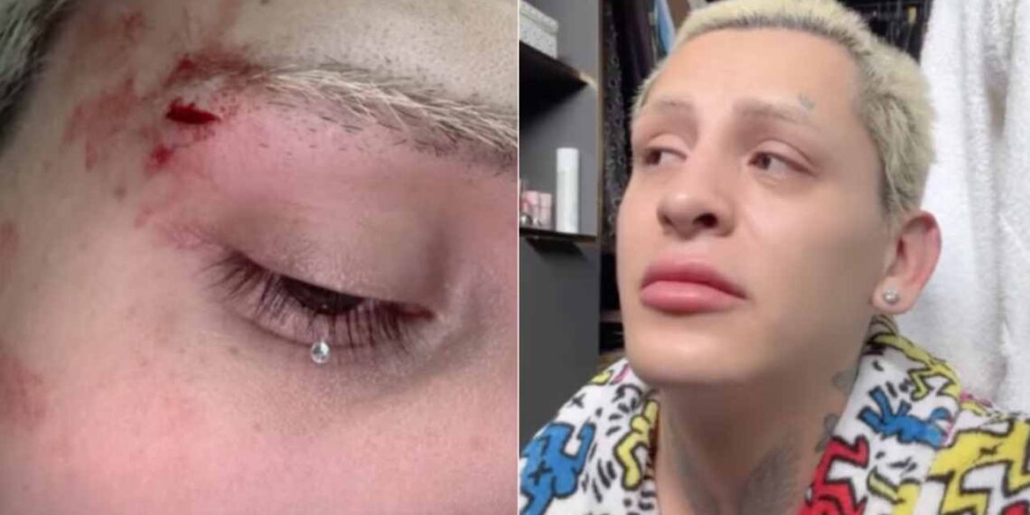 Esto se sabe de la agresión a Kunno en San Pedro en Nuevo León