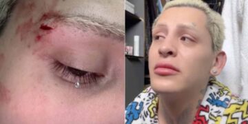 Esto se sabe de la agresión a Kunno en San Pedro en Nuevo León