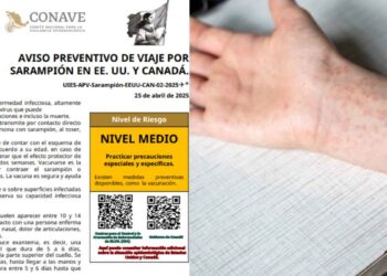 Secretaría de Salud emite alerta a viajeros por casos de sarampión en Estados Unidos y Canadá