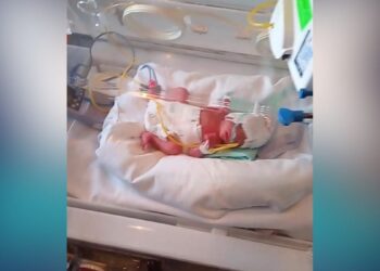 bebe prematuro ayuda Ciudad Victoria