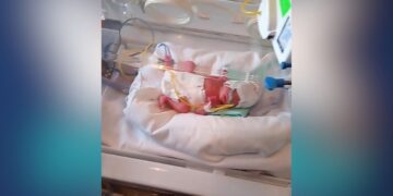 bebe prematuro ayuda Ciudad Victoria