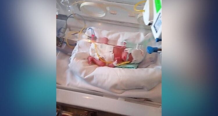 bebe prematuro ayuda Ciudad Victoria