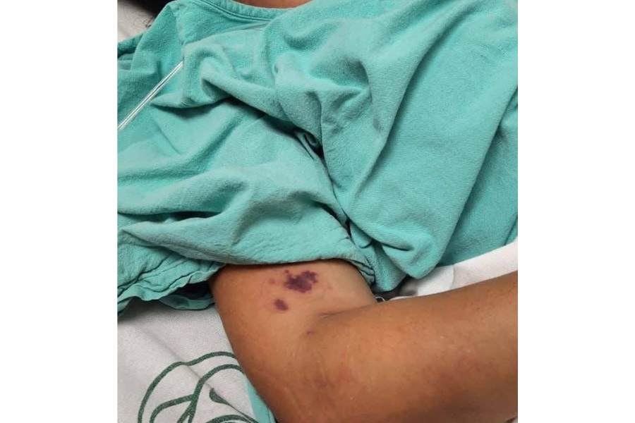 negligencia médica en IMSS Madero