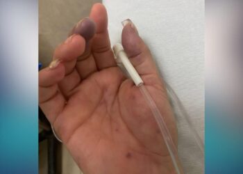 negligencia médica en IMSS Madero