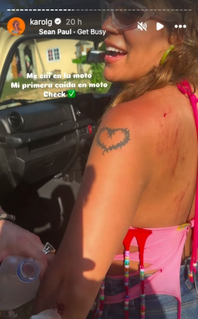 Karol G sufre caída en moto durante vacaciones en Jamaica