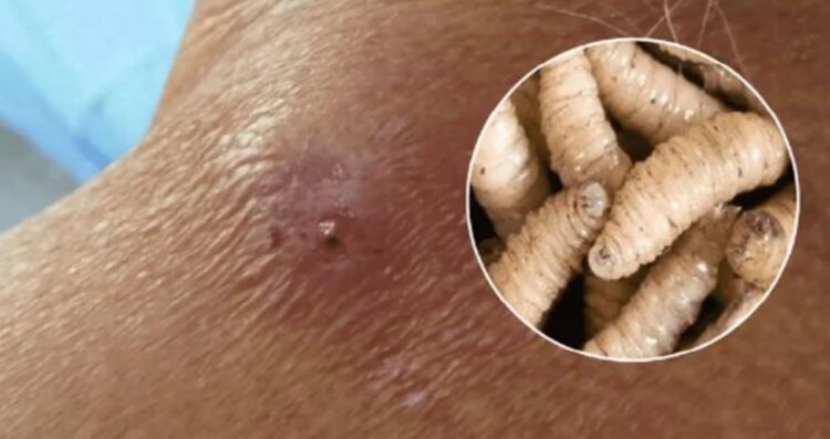 ¿Cuáles son los síntomas del gusano barrenador y existe vacuna contra la miasis?