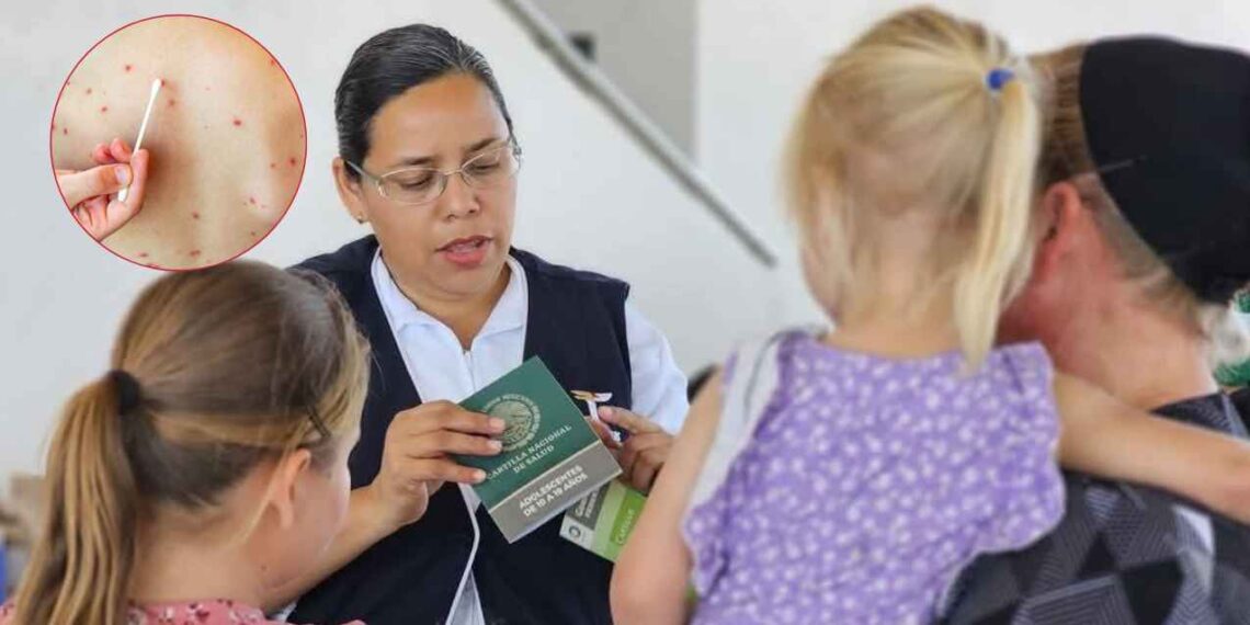 Caso sarampión enciende alertas sanitarias en González