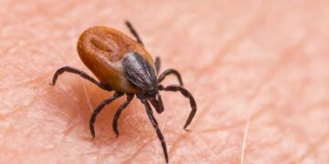 Confirman primer fallecimiento por rickettsia en Gómez Palacio en 2025