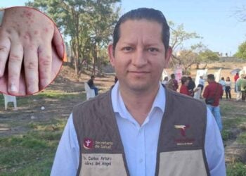 Detectan tres casos de sarampión en Aldama y González; brote está bajo control