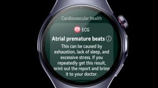 Cómo elegir el smartwatch adecuado para ti