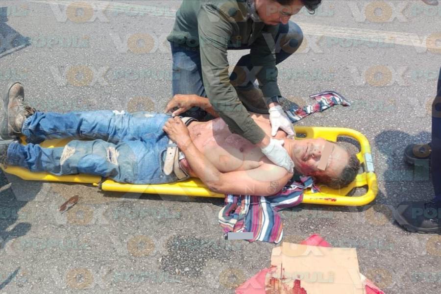 hombre atropellado en Altamira