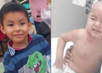 ayuda para niño con leucemia en Victoria