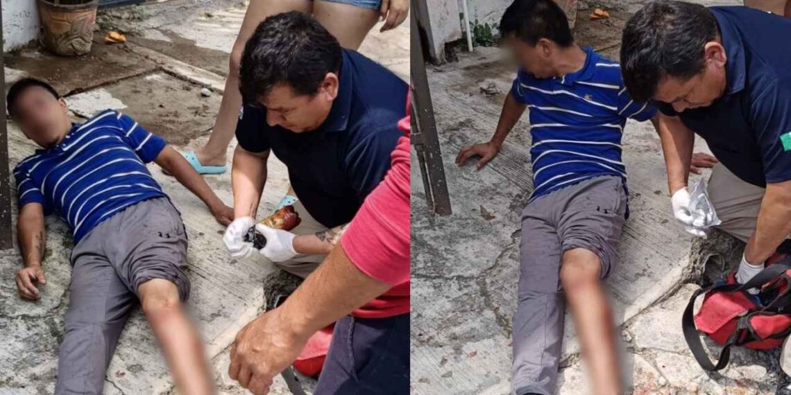 Transeúnte sufre mordedura de perro en Cd. Victoria