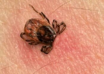 Rickettsia cobra la vida de niño en Saltillo; su hermano también está enfermo