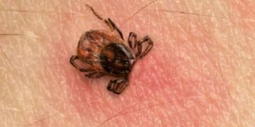 Rickettsia cobra la vida de niño en Saltillo; su hermano también está enfermo