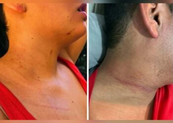 Turistas denuncian agresión Tepoztlán