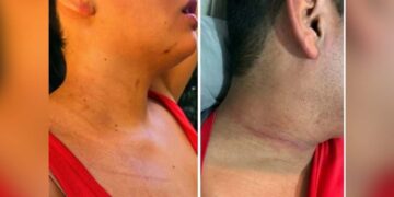 Turistas denuncian agresión Tepoztlán