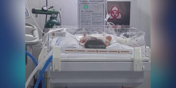bebé en cuidados intensivos en Victoria