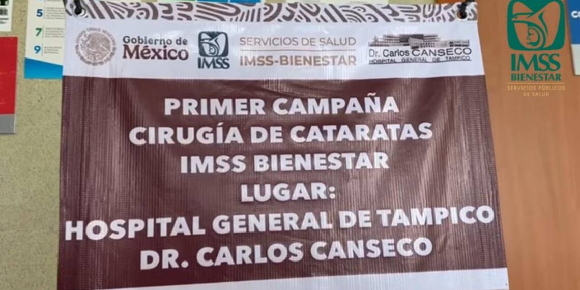 cirugía de cataratas gratis en Tampico