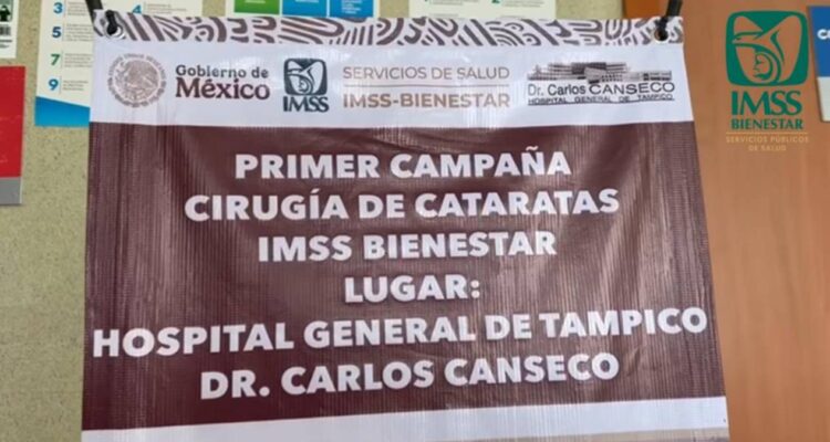 cirugía de cataratas gratis en Tampico