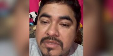 cirugía desprendimiento de retina en Victoria