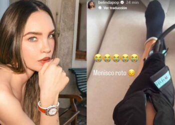 Belinda revela lesión en la rodilla y preocupa a sus seguidores ¿Cuál es su estado de salud