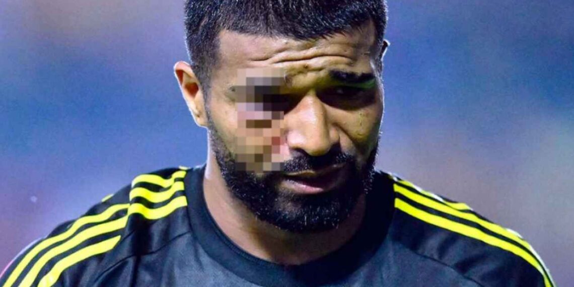 _'Búfalo' Aguirre sufre golpe ojo