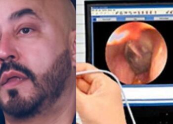 Lupillo Rivera revela que perdió la audición de un oído
