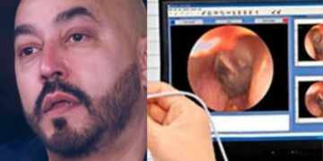 Lupillo Rivera revela que perdió la audición de un oído